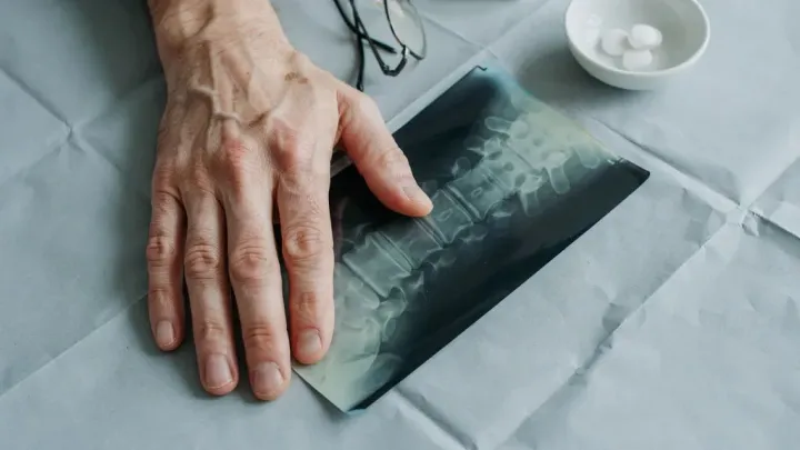 andriki osteoporosi