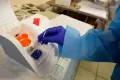Νέες Ελπίδες για την Αντιμετώπιση του Λιπώδους Ήπατος με το Φάρμακο ION224